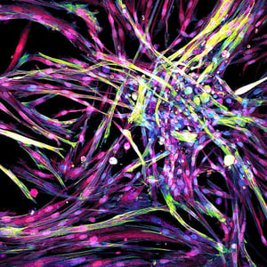 Human skeletal muscle myoblast stained with Hoechst, Phalloidin, MitoTracker CMXROS, and CellMask Deep.