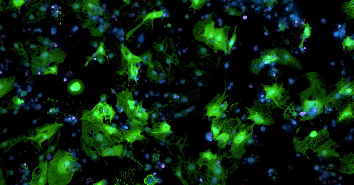 Human, iPSC-derived cardiomyocytes transduced with AAV carrying a GFP gene.