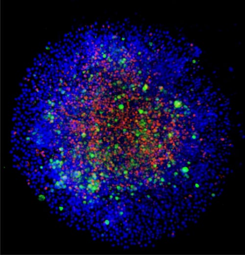 A549 spheroid co-cultured with CAR-T cells for 48 hours, labeled for nuclei (blue), A549 cells (CellTracker Green), and CAR-T cells (CellTracier Red).
