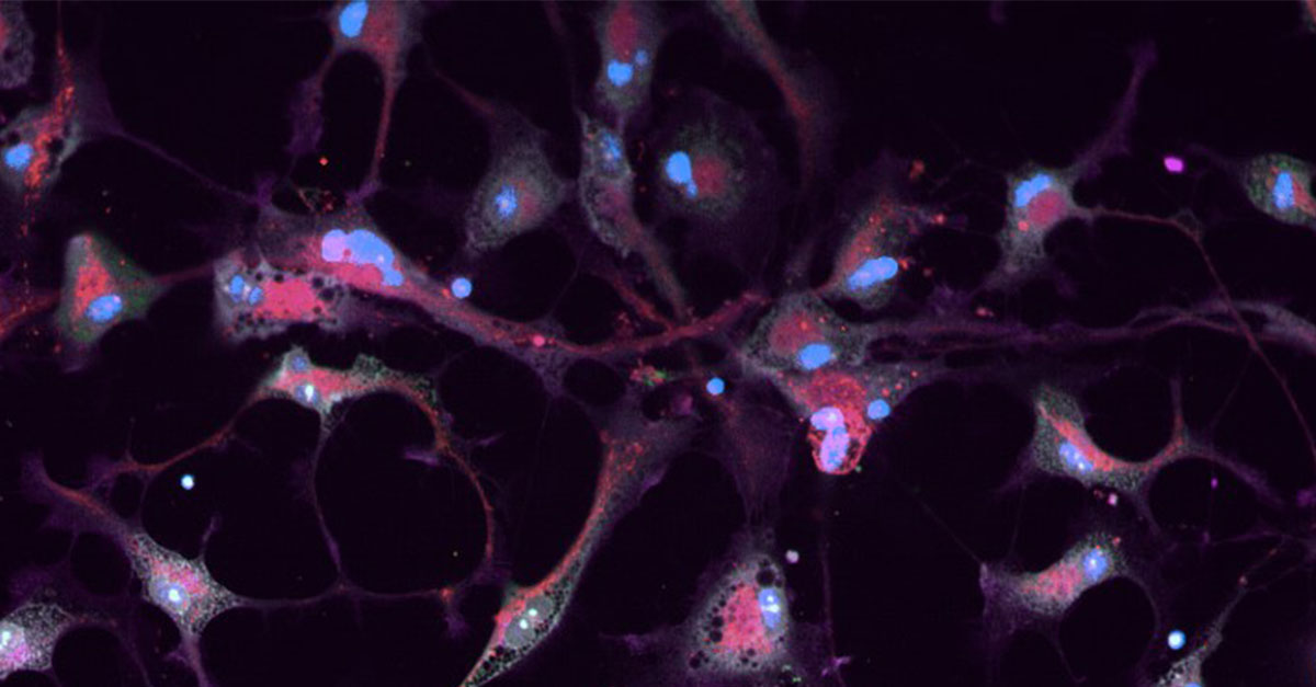 cell-painting-astrocytes-1200x627