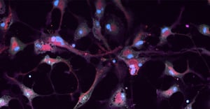 cell painting astrocytes