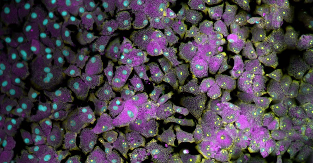 cell-painting-hepatocytes-blog-page-1200x627