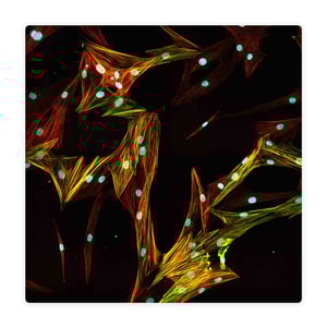 Primary normal human lung fibroblasts stained with Hoechst, alpha-SMA, phalloidin/F-actin, and alpha-SMA/F-actin overlap.