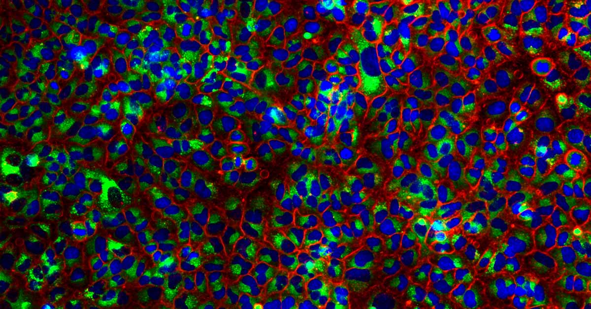 A549 cells stained for nuclei (blue), autophagosomes (red), and autolysosomes (green).