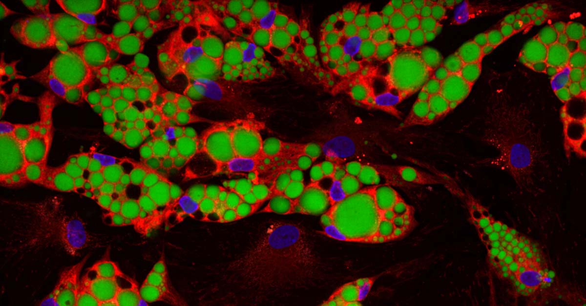 Adipocytes stained with Hoechst, BODIPY, and MitoTracker Deep Red FM.