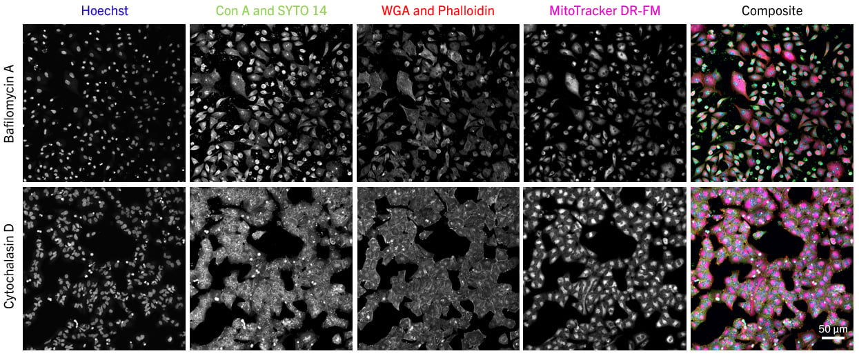 A549 cells showing different phenotypic profiles after treatment with bafilomycin A vs cytochalasin D.