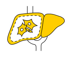liver-fibrosis-icon