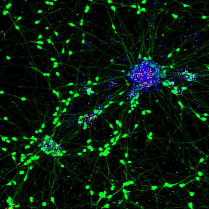 Neurotox24h_Eyecandy_Composite_071123_1_RGB-LR