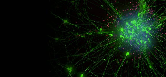 r2g-neuro-AAV-banner