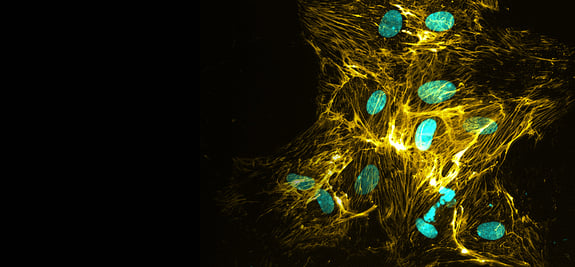 r2g-liver-fibrosis-banner-v3