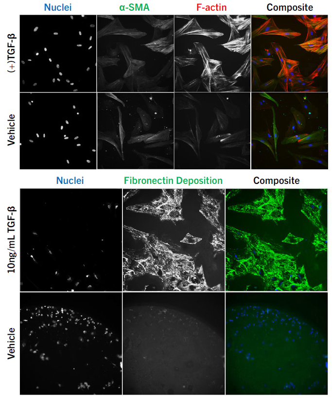 r2g-liver-fibrosis-img1