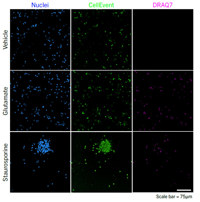 parkinsons-neurotoxicity-rep-images