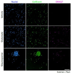 parkinsons-neurotoxicity-rep-images