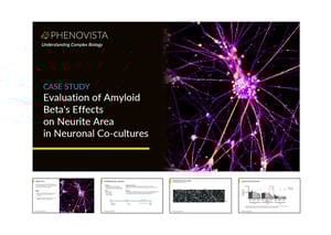 Abeta-neuronal-co-culture-thumbnail