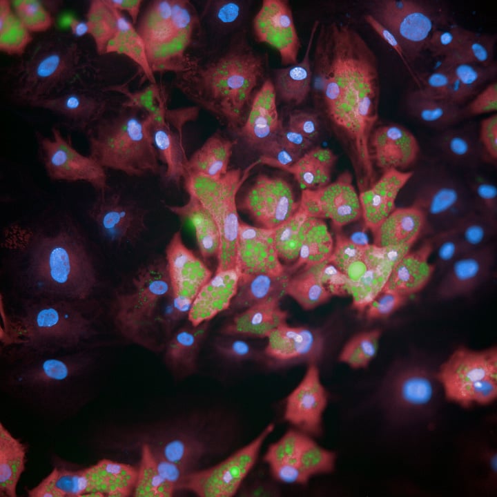 adipogenesis