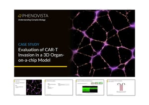 CAR-T-organ-chip-thumbnail