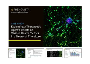 CNS-tri-culture-thumbnail