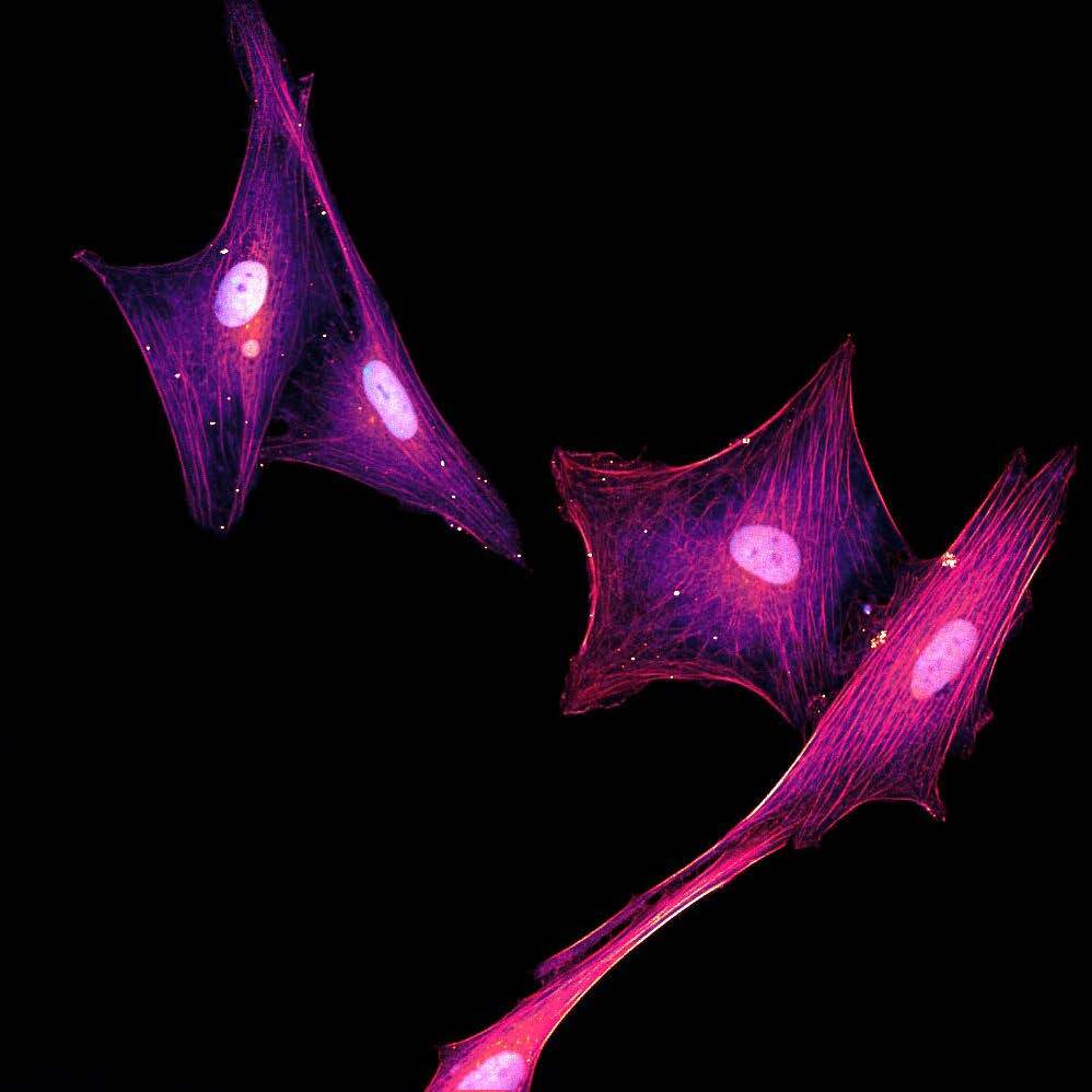 fibrosis-in-HSCs