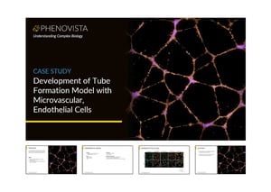 HMEC-tube-formation-thumbnail