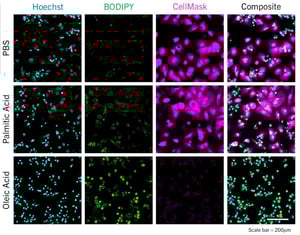 rep-images-hepatocytes-OA-PA