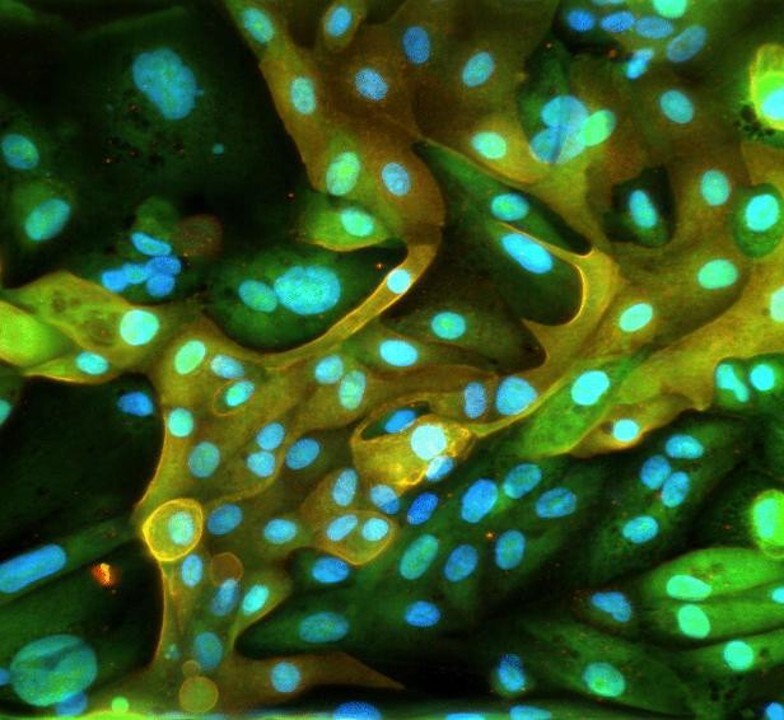 migration-of-primar-human-aortic-endothelial-cells