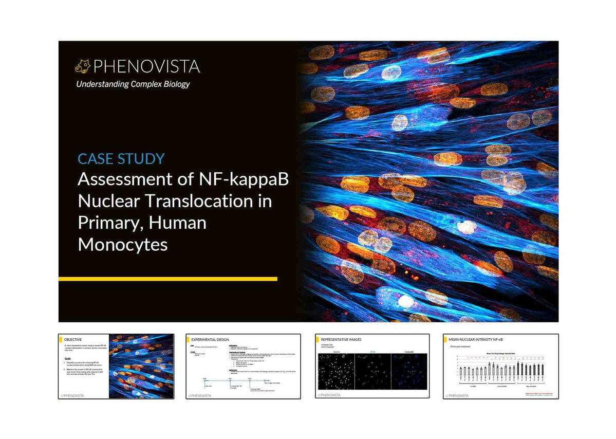 Assessment of NF-kappaB Nuclear Translocation in Primary, Human Monocytes