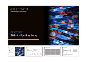 THP-1-migration-thumbnail