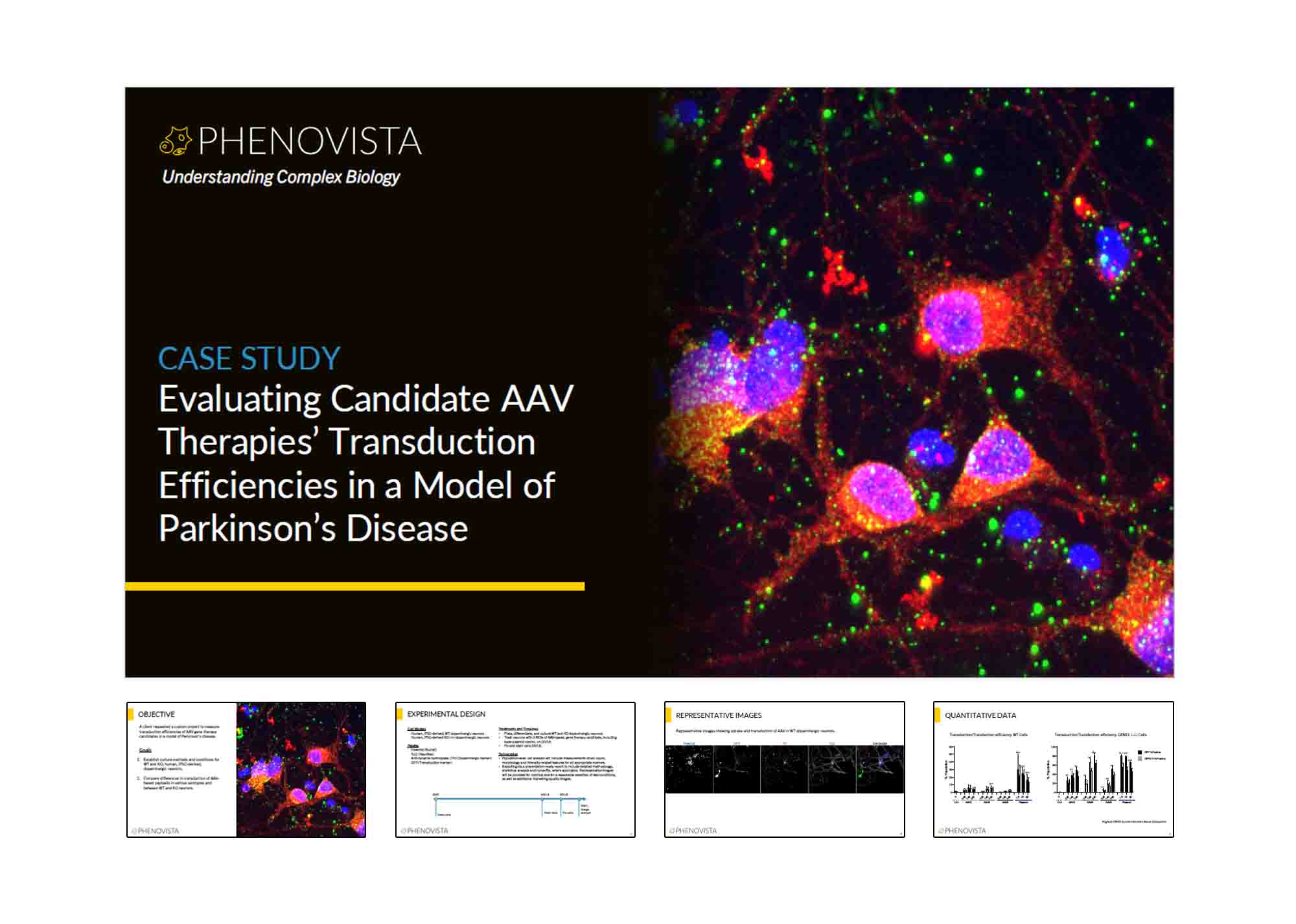aav-parkinsons-thumbnail