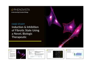 fibrosis-in-HSCs-thumbnail