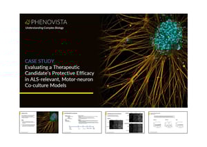motor-neurons-coculture-ALS-thumbnail