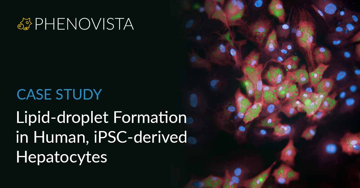 hepatocytes-lipid-thumbnail-1200x627