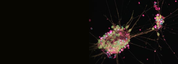 bespoke-services-banner-neuro