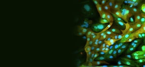 migration-aortic-endothelial-cells-banner