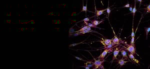 oncology-research-area-banner