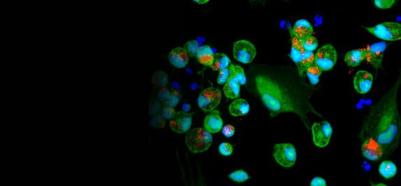 r2g-microglia-phagocytosis-banner
