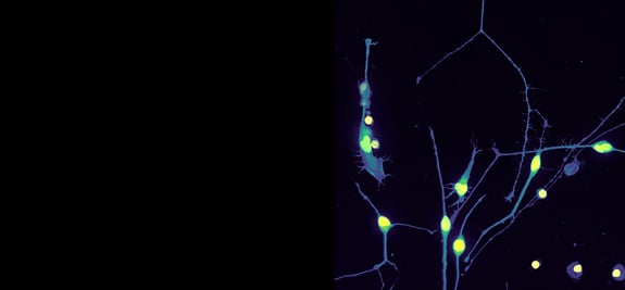 r2g-neurite-network-dynamics-banner-v3