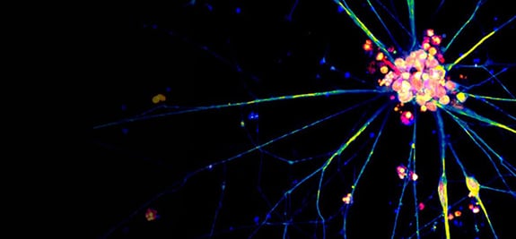 r2g-neuronal-mitohealth-banner