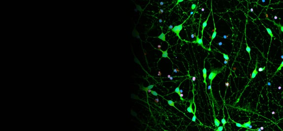 r2g-neurotoxicity-banner