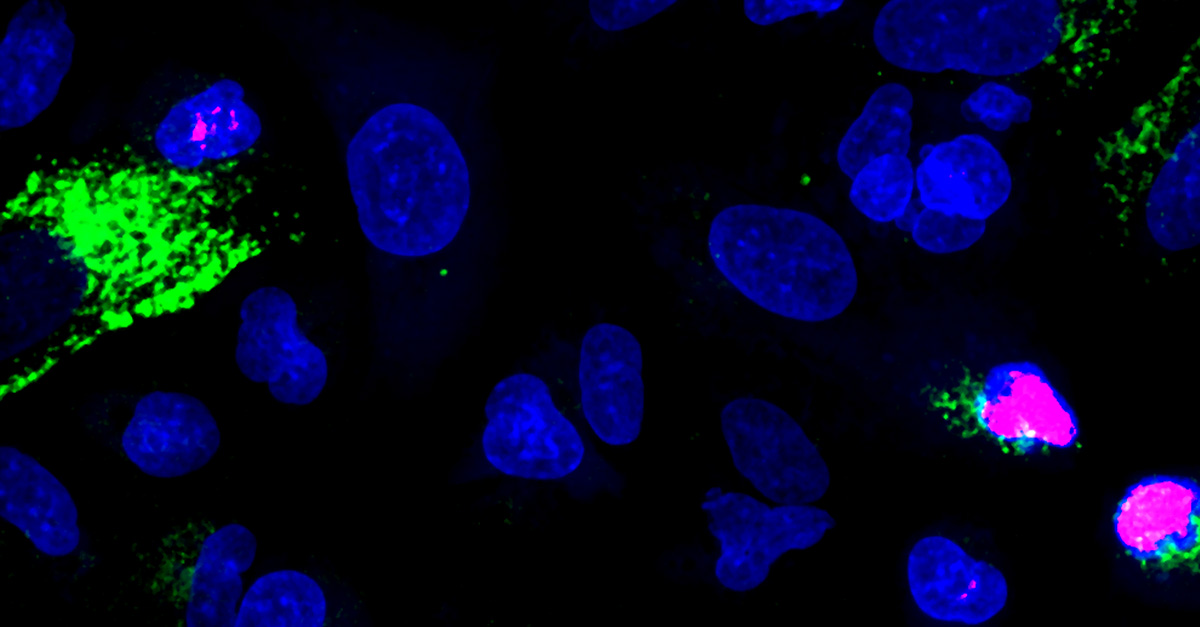 A549 cells stained with Hoechst, CellEvent, and DRAQ7.