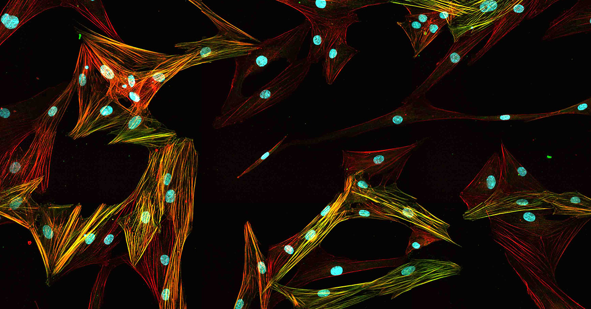 Primary normal human lung fibroblasts stained with Hoechst, alpha-SMA, phalloidin/F-actin, and alpha-SMA/F-actin overlap.