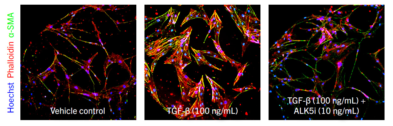 Representative cell images of a model of lung fibrosis following exposure to different drug treatments