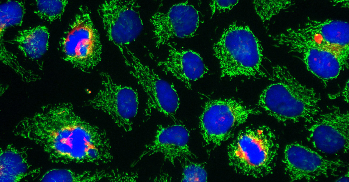 A549 cells stained with Hoechst, MitoTracker CMXRos, and DRAQ7.