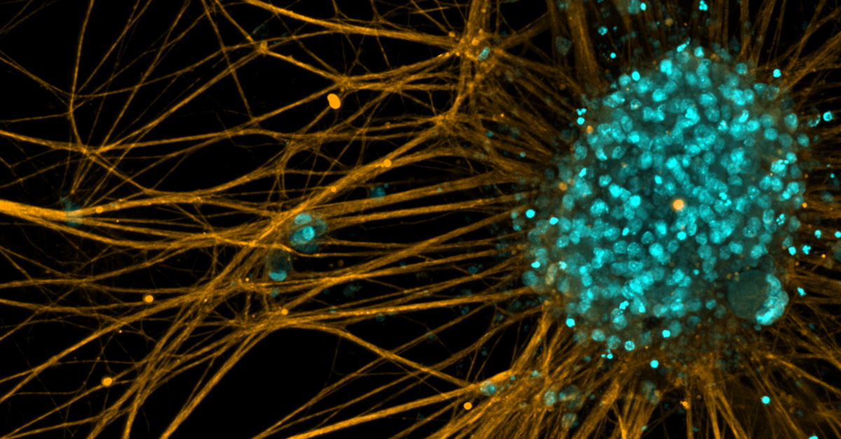 FUJIFILM Cellular Dynamics' iCell motor neurons stained with Hoechst and Tuj-1.