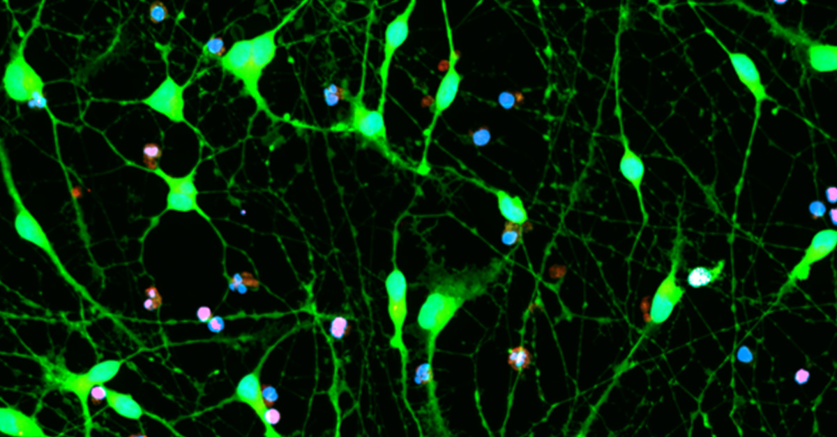 Human iPSC-derived glutamatergic neurons stained with Hoechst, CellMask, and DRAQ7.