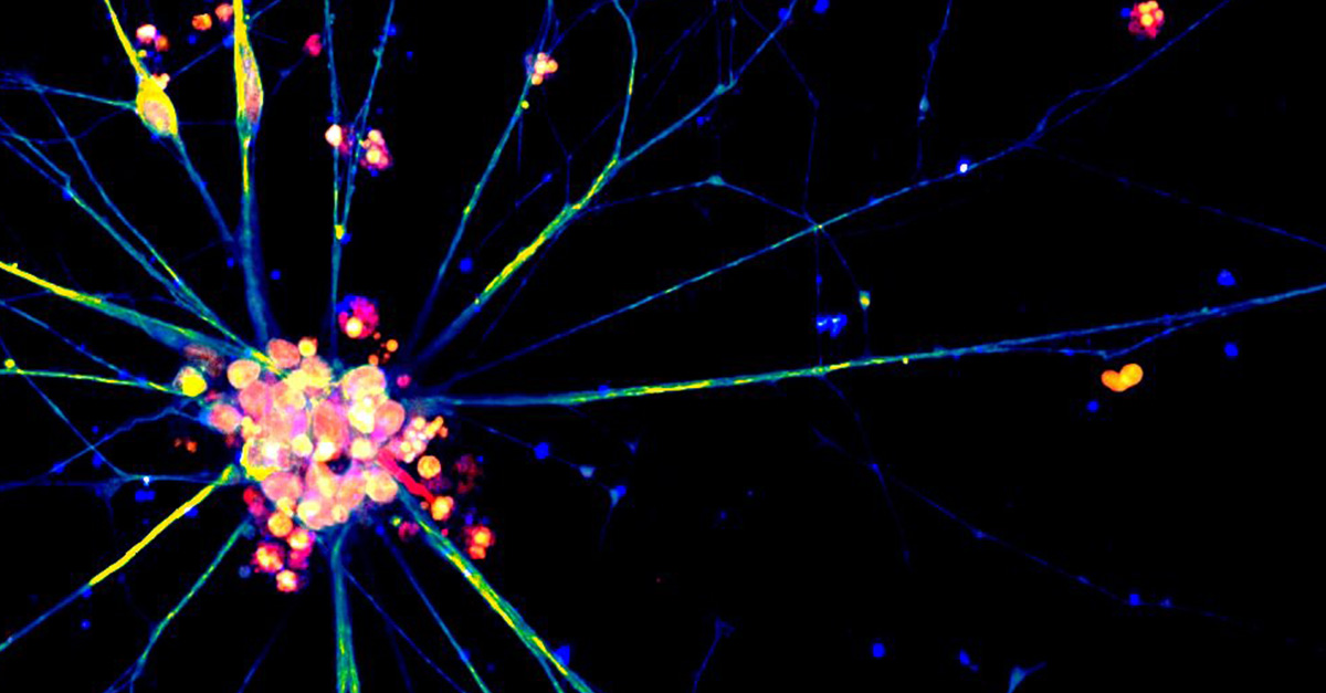 FUJIFILM Cellular Dynamics' iCell neurons stained with Hoechst, Tuj-1, and synaptophysin.