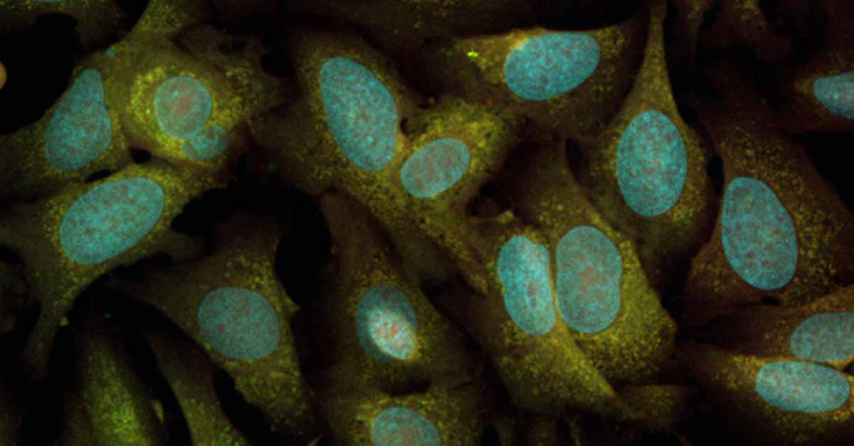Cell-based Assays and High-content Imaging in Antisense-oligonucleotide ...