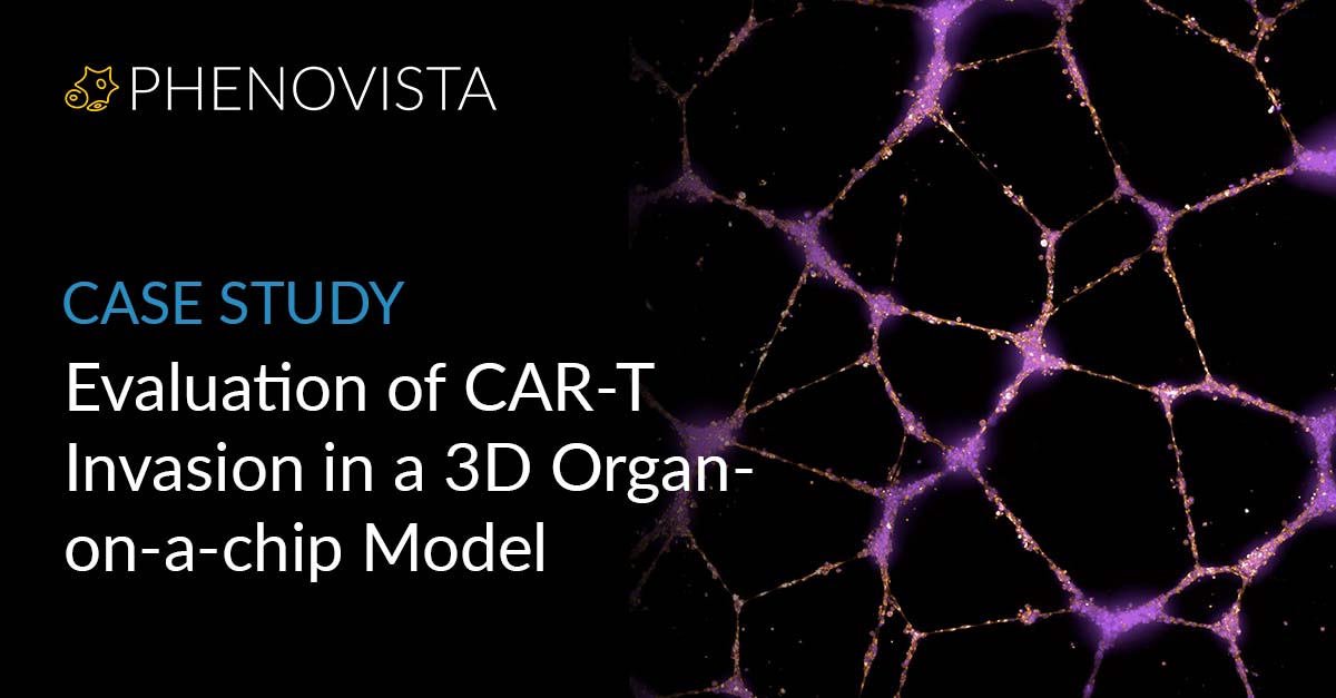 CAR-T-organ-chip-thumbnail-1200x627