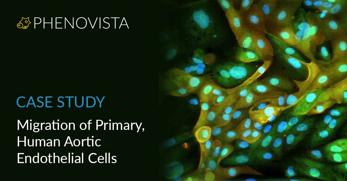 Migration-of-aortic-endothelial-cells-thumbnail-1200x627-v2
