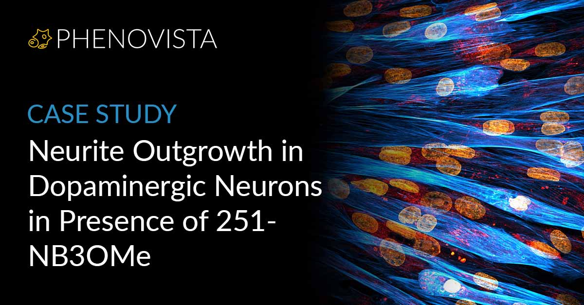 Neurite-outgrowth-NB3OMe-thumbnail-1200x627