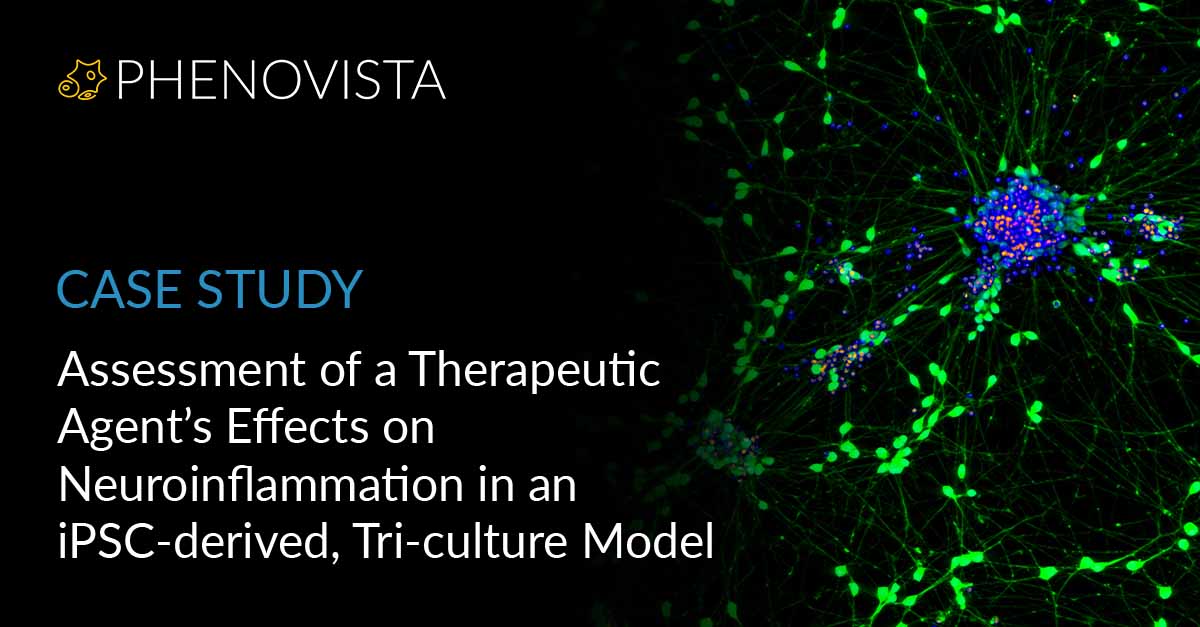 Neuroinflammation-tri-culture-thumbnail-1200x627